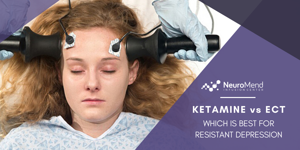 ketamine-vs-ect-which-is-best-for-resistant-depression